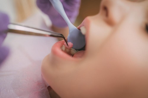 A dentist performing check-up on a girl